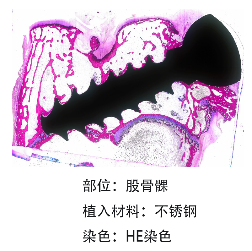 股骨髁1.png